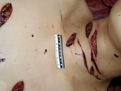 Woman stabbed to death with a partial autopsy at the scene