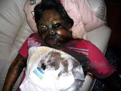 A mix of decaying corpses