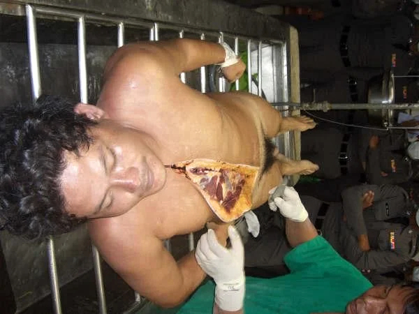 A collection of autopsies of various men