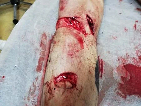 Romania: That's a brutal attack