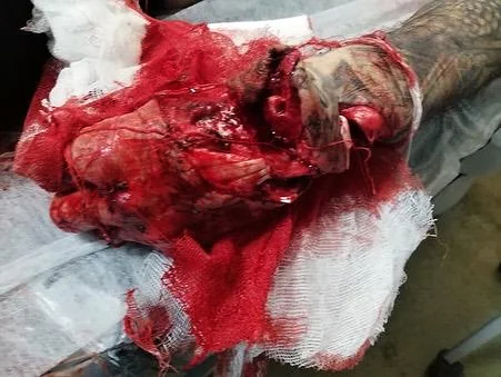 Romania: That's a brutal attack