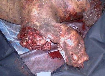 Man involved in horrific car accident