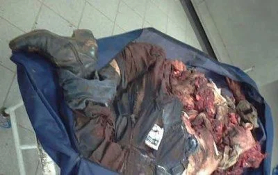 Man involved in horrific car accident