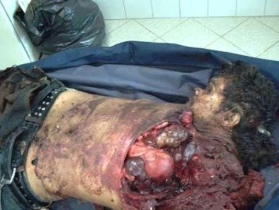 Man involved in horrific car accident