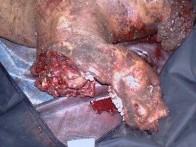 Man involved in horrific car accident