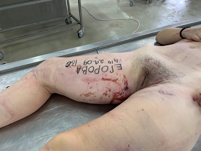 Young woman with cracked skull