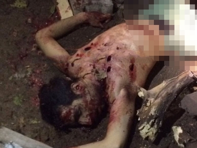 Turkish soldiers are not breathing in the pkk