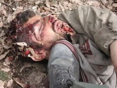 Turkish soldiers are not breathing in the pkk