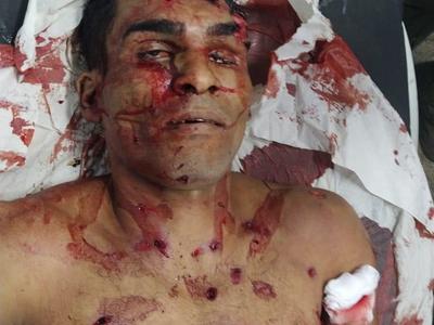 Brazilian serial killer LÃ¡zaro Barbosa de Sousa dead.