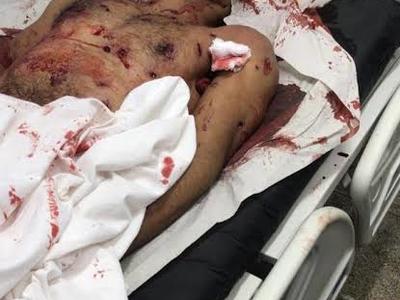 Brazilian serial killer LÃ¡zaro Barbosa de Sousa dead.