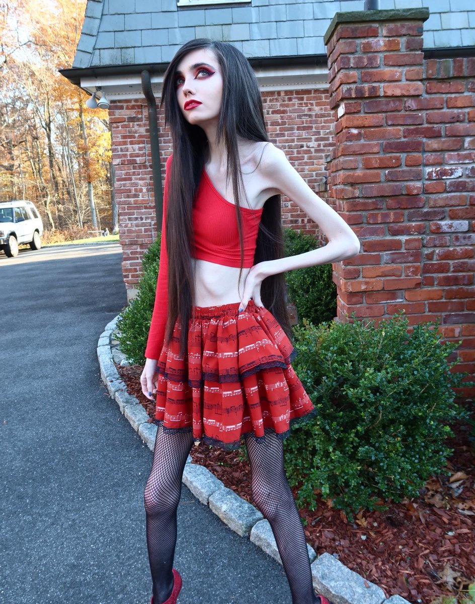 Eugenia Cooney anorexic