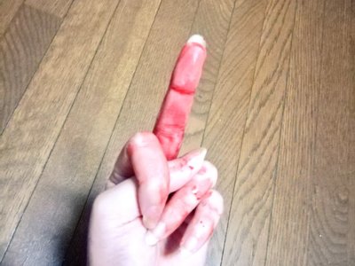 depressed teenager bloody self harm 