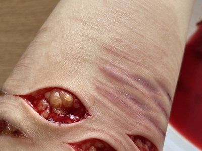 depressed teenager bloody self harm 