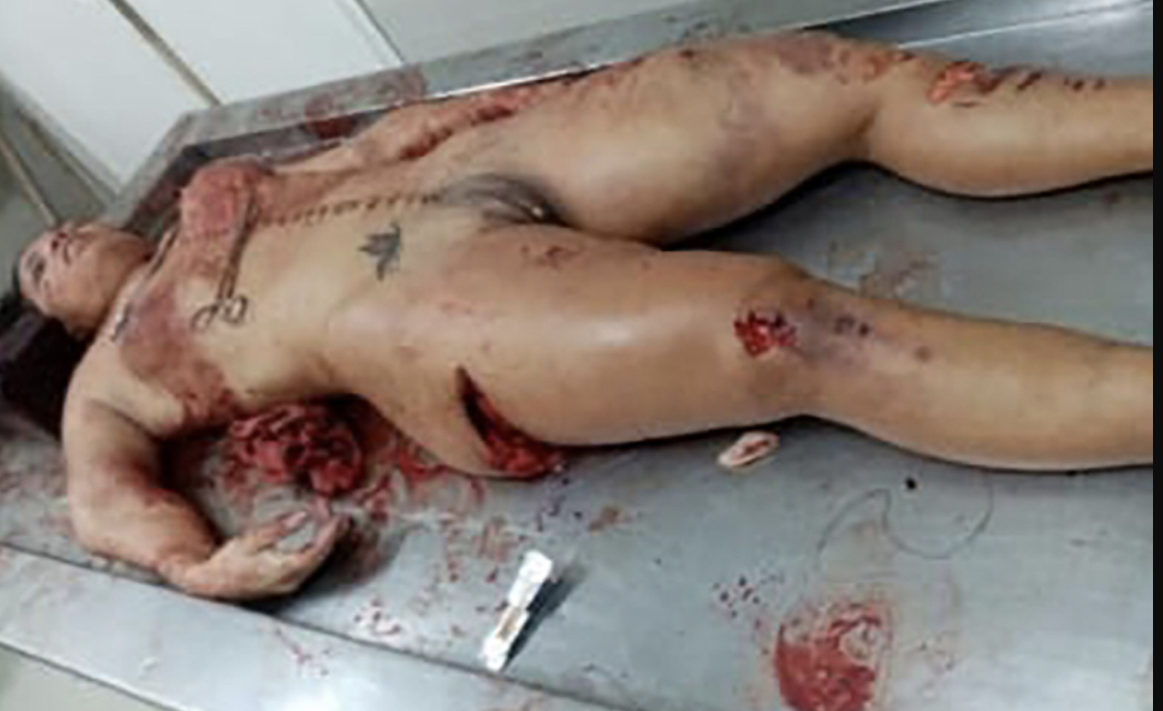 Autopsy & social media images of girl (Saritah Mendoza) from Bolivian couple suicide.