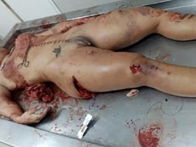 Autopsy & social media images of girl (Saritah Mendoza) from Bolivian couple suicide.