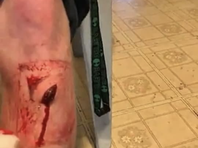 Steel Bicycle Pedal are Shin killers