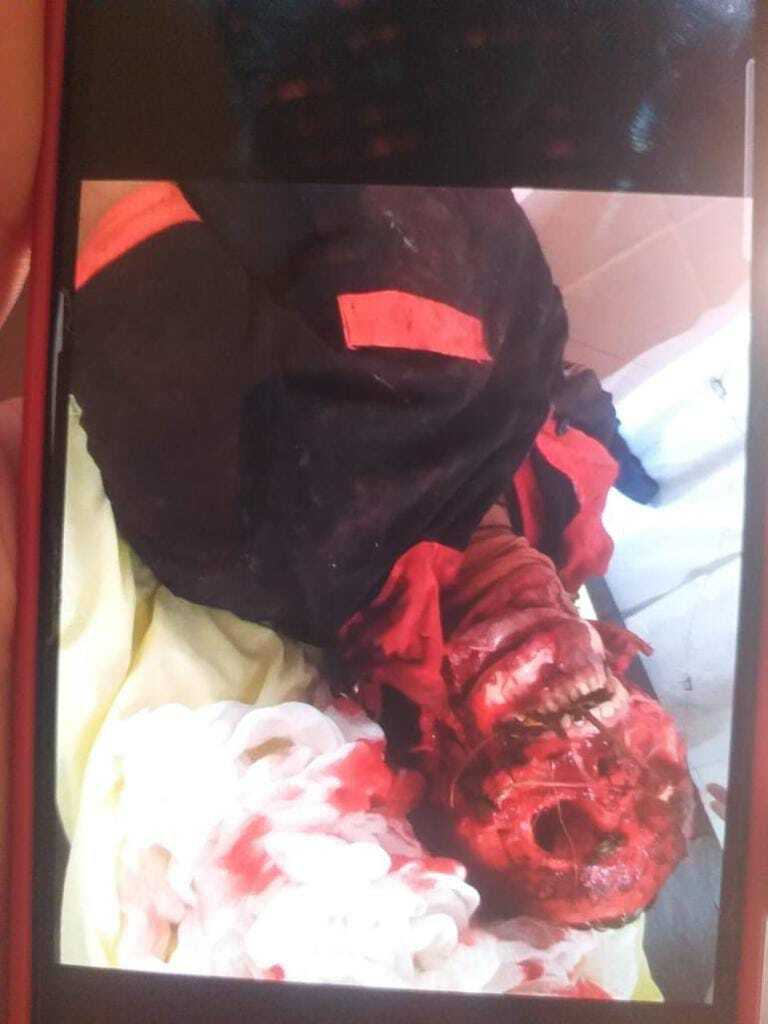 DAMN: Murdered Woman Found with Face Removed