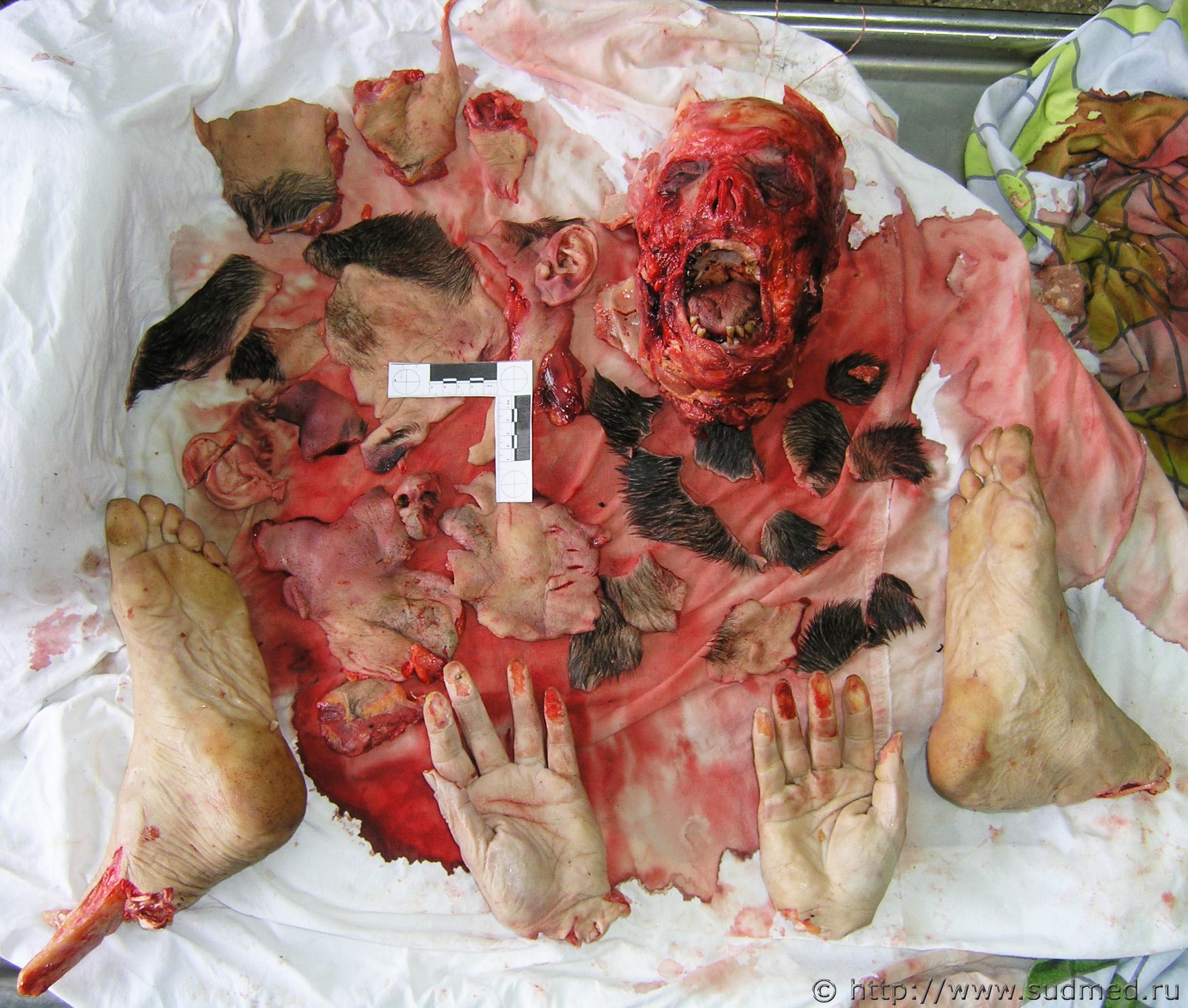 Russian Alcoholic Dismembers Another Alcoholics Head