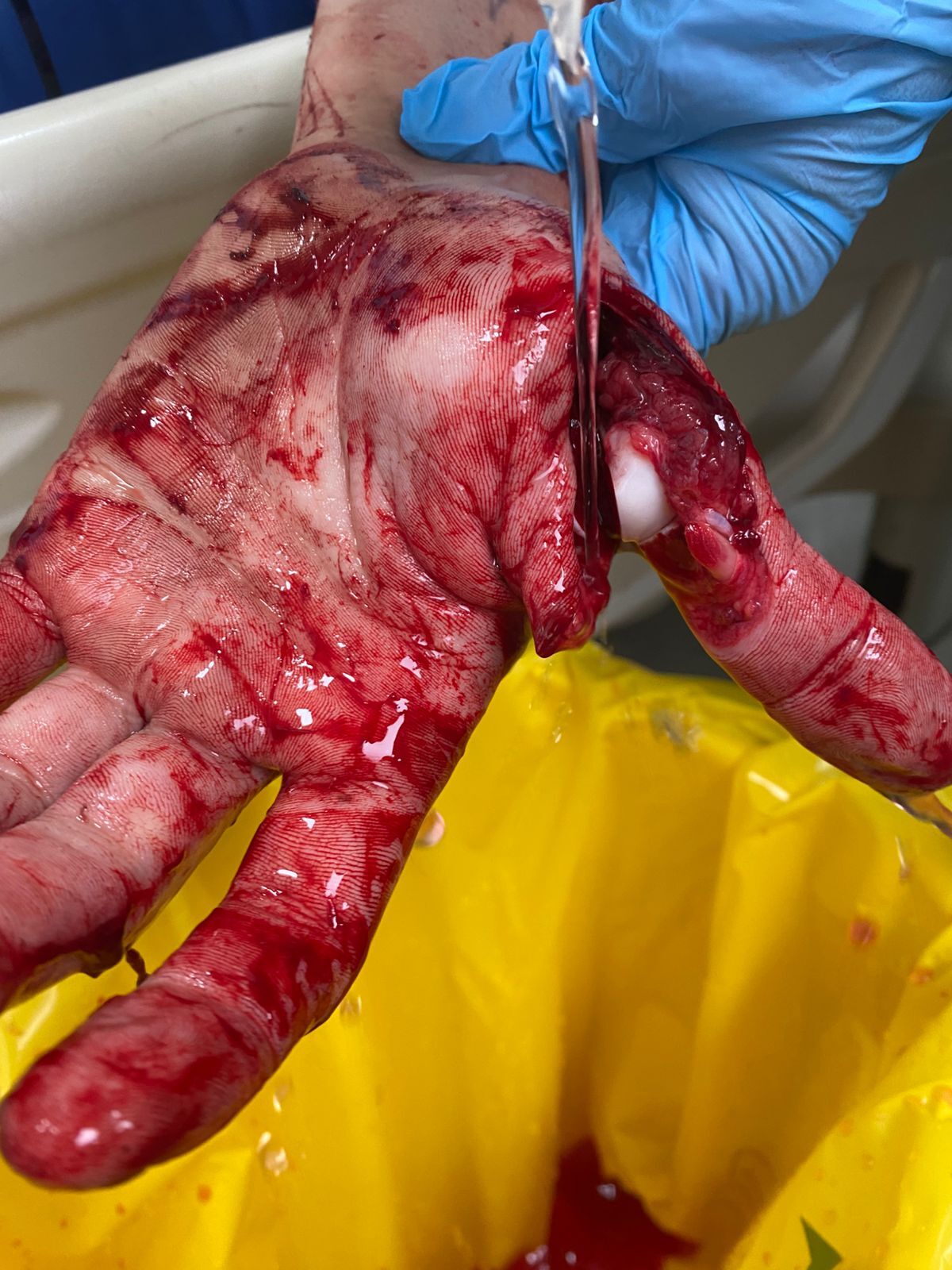 Colleague in processing plant attacks with butcher's knife