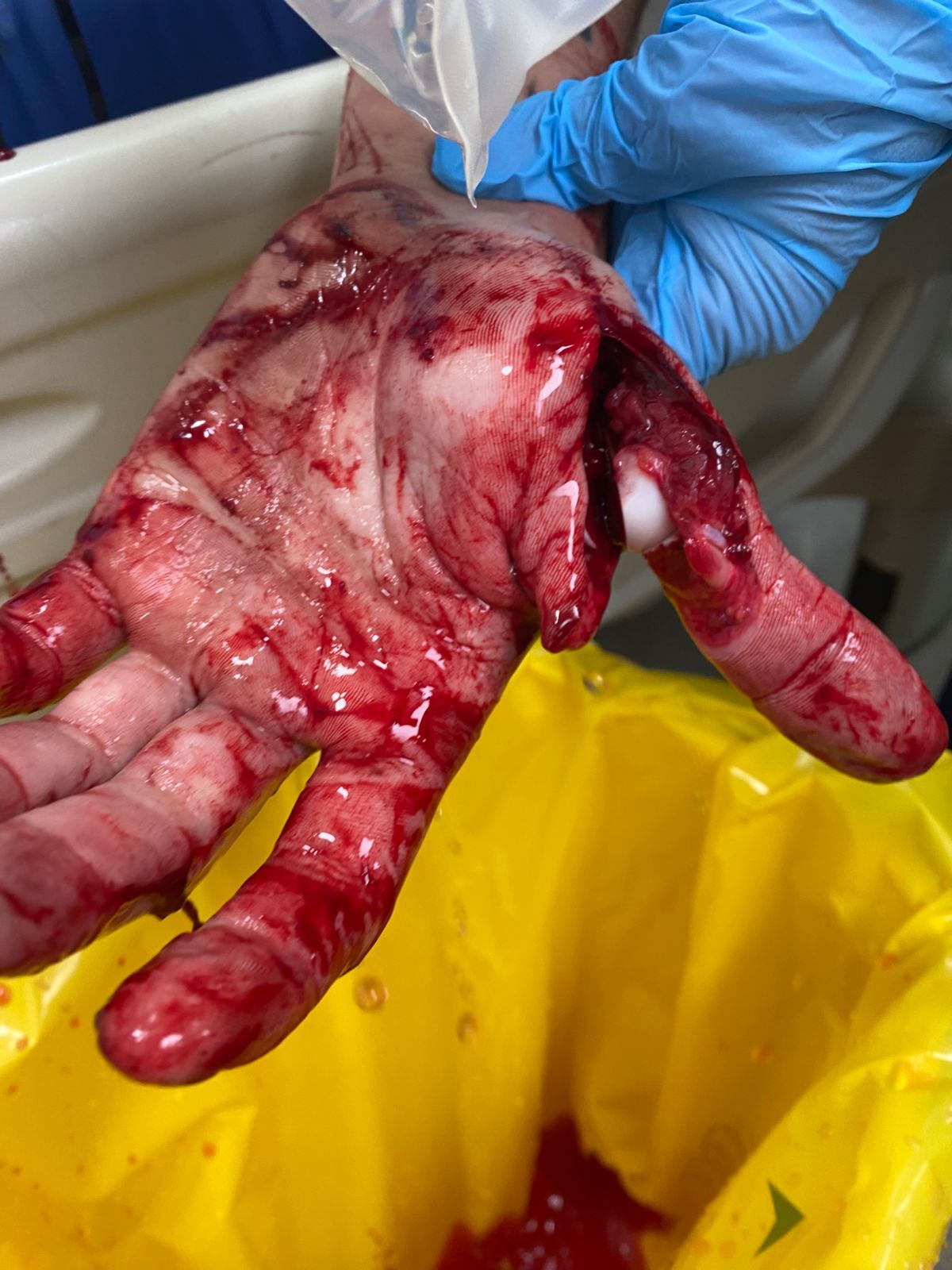 Colleague in processing plant attacks with butcher's knife