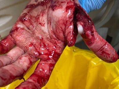 Colleague in processing plant attacks with butcher's knife