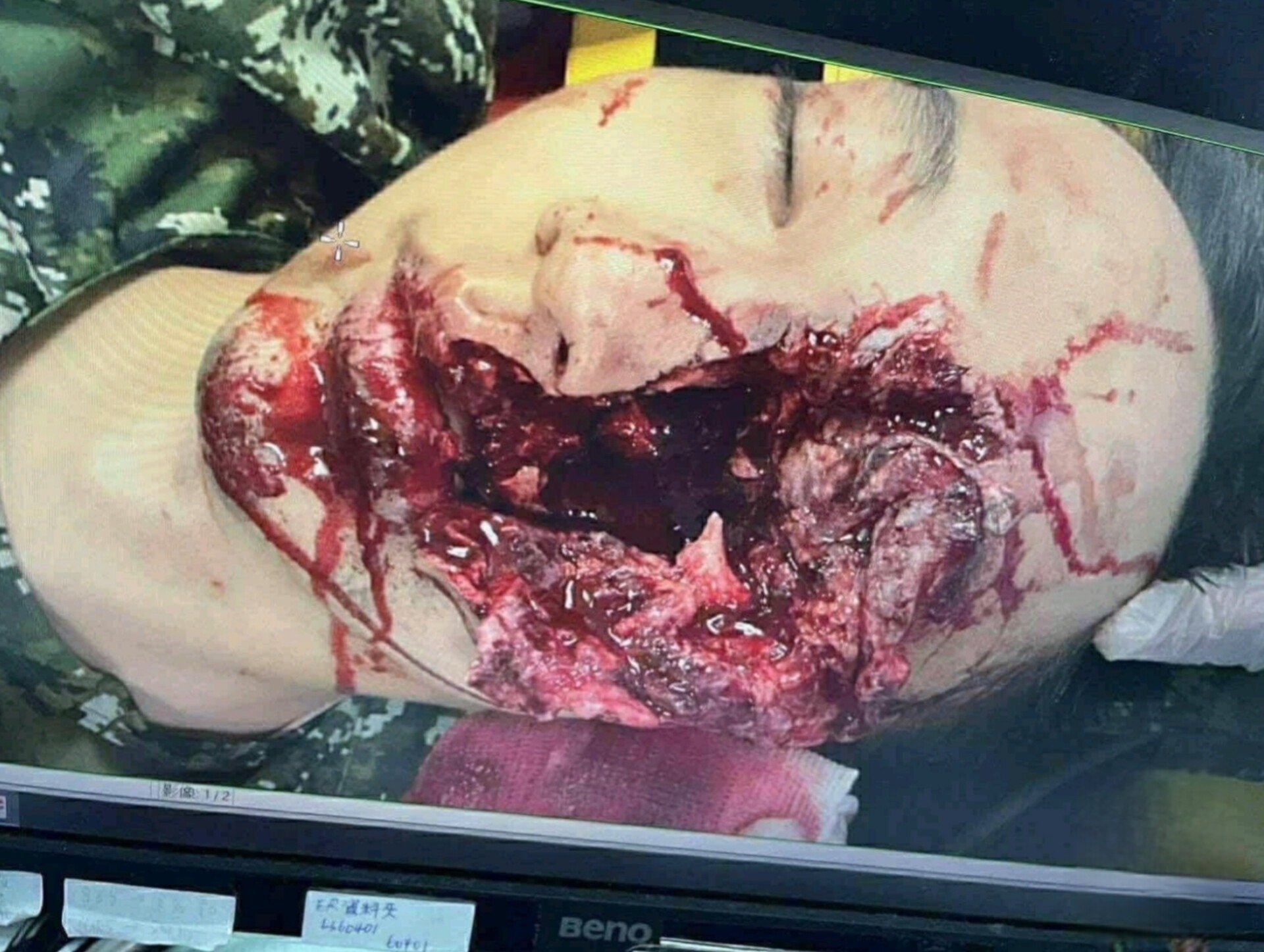 Soldier seriously injured in shooting accident in Taiwan, China.