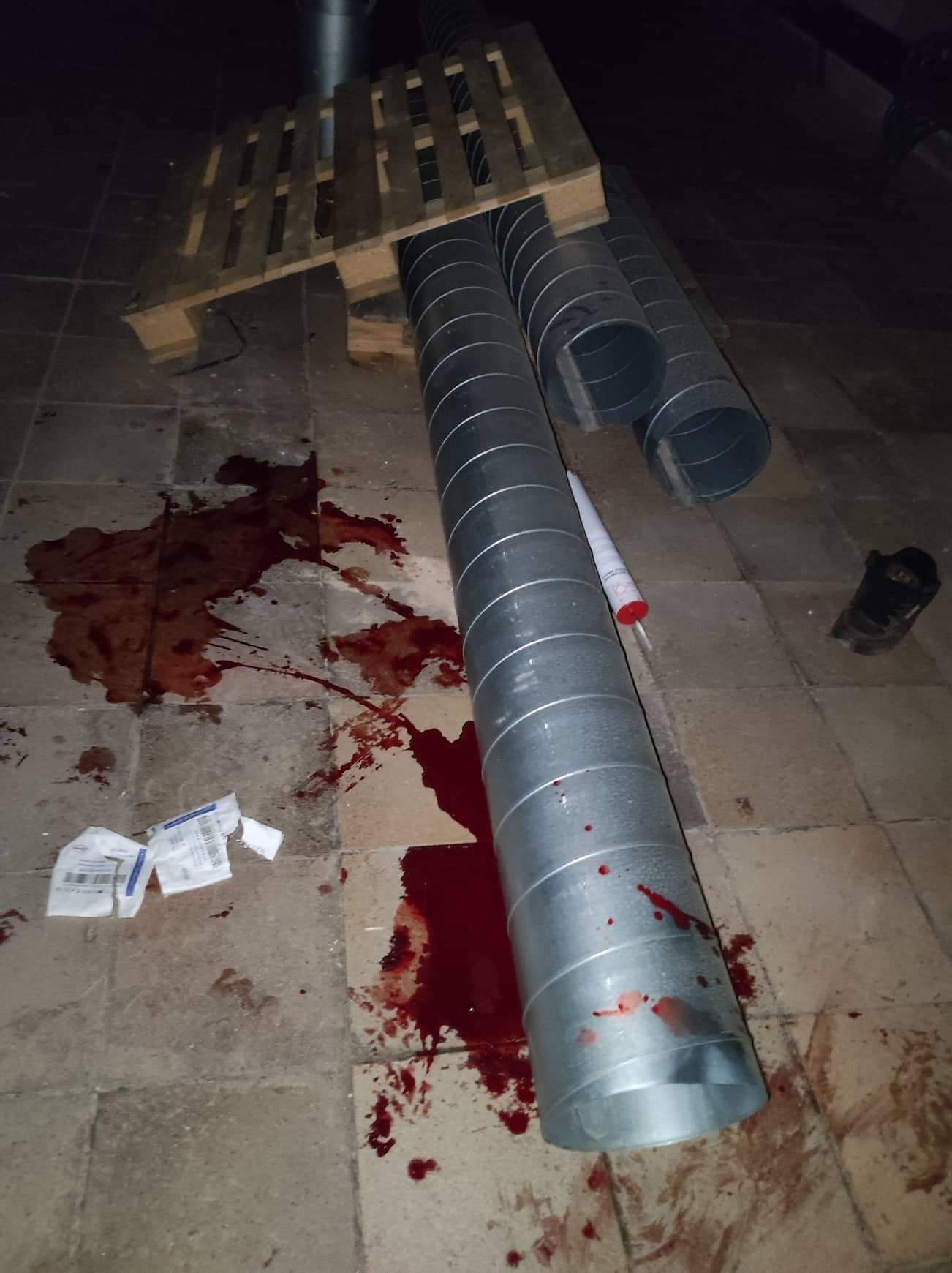 Bike crash injuries.