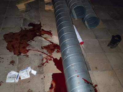 Bike crash injuries.