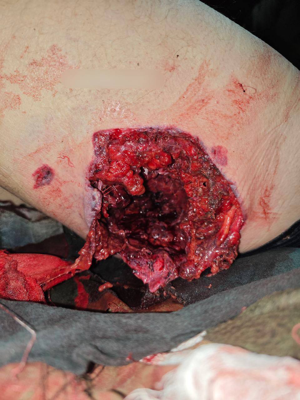 God bless America. Thanks for the cluster munition.