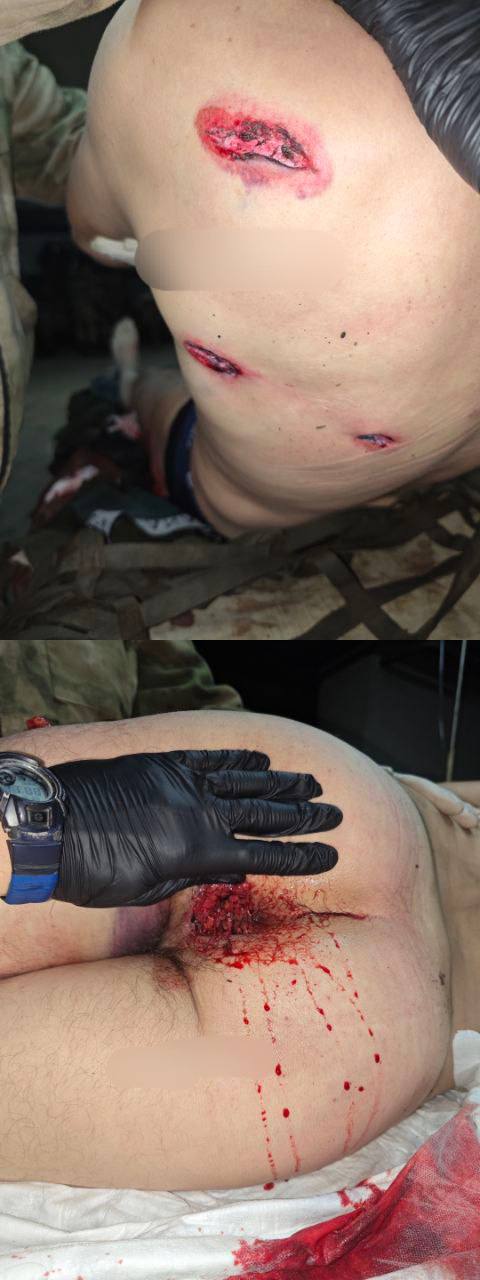 God bless America. Thanks for the cluster munition.