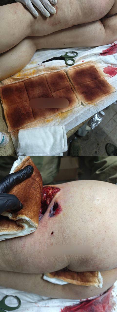 God bless America. Thanks for the cluster munition.