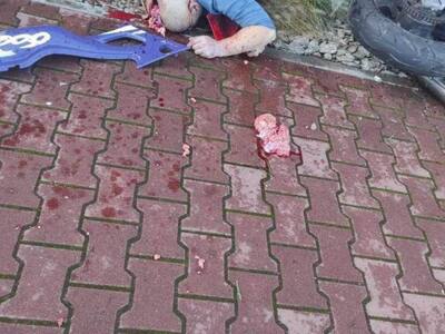 Aftermath of trying powerful motorcycle for the first time