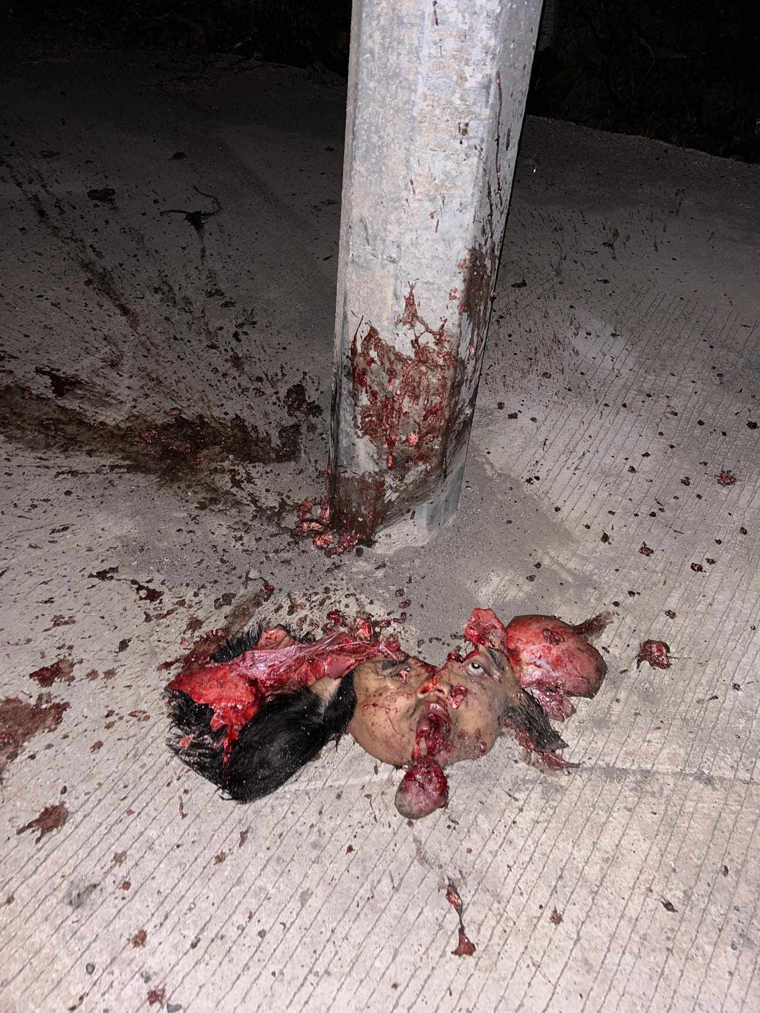 Accident in gapan Nueva Ecija Philippines