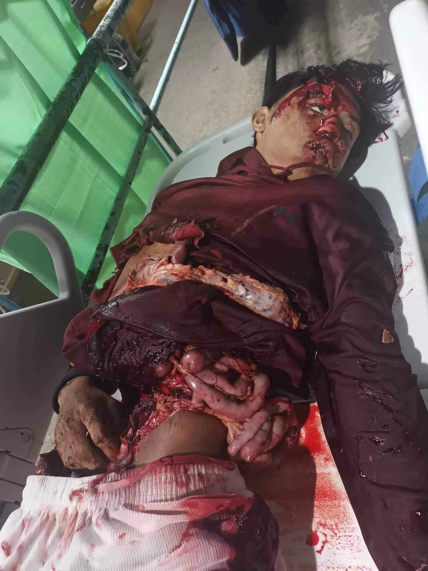 Accident in gapan Nueva Ecija Philippines