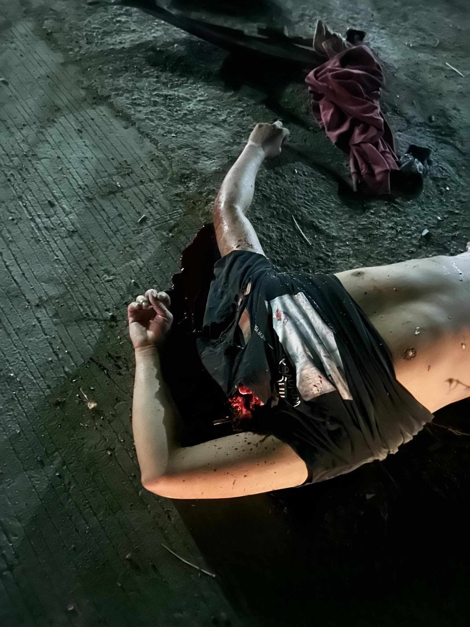 Accident in gapan Nueva Ecija Philippines