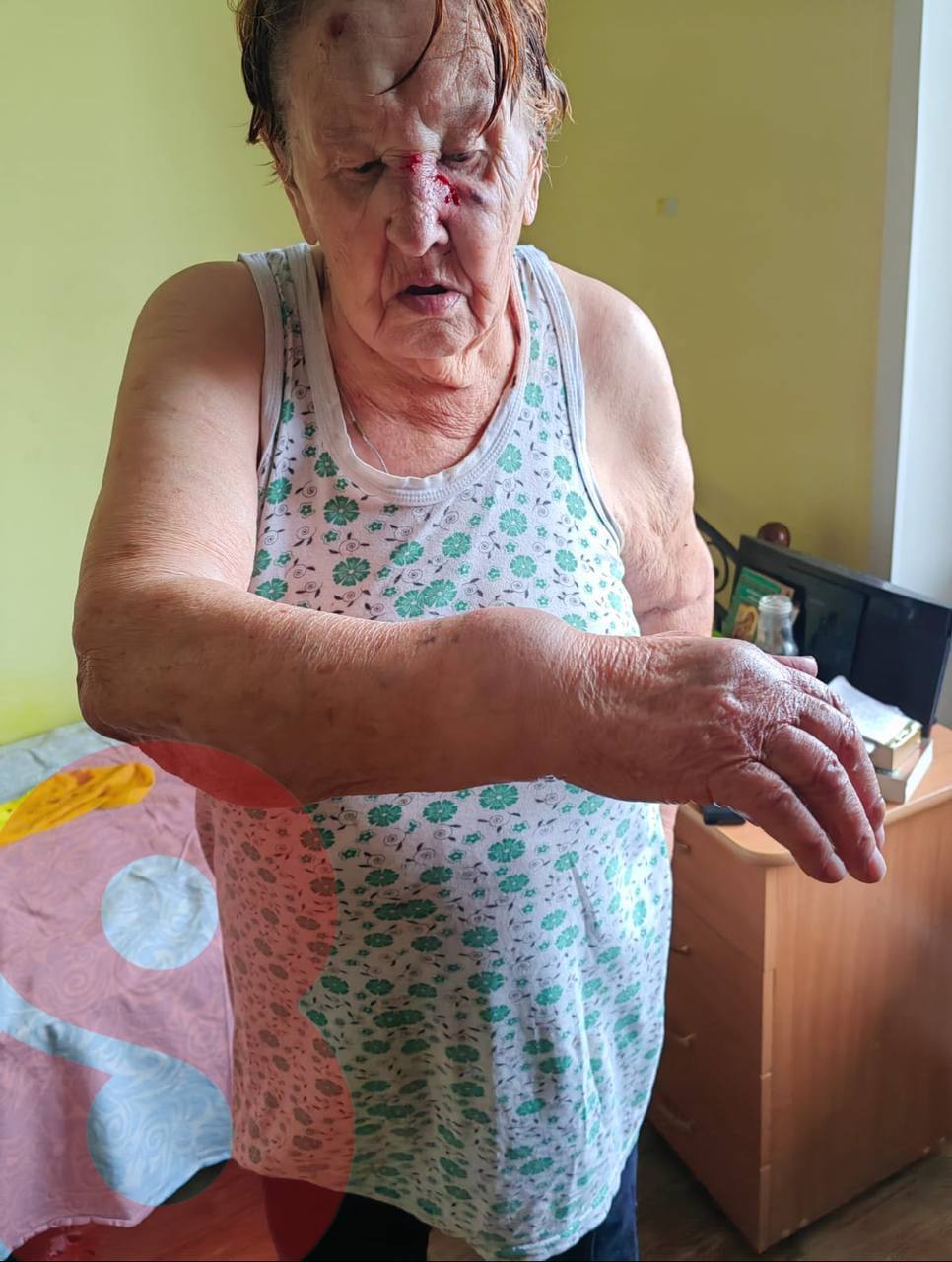 Grandma Gets Beaten By Neighbors