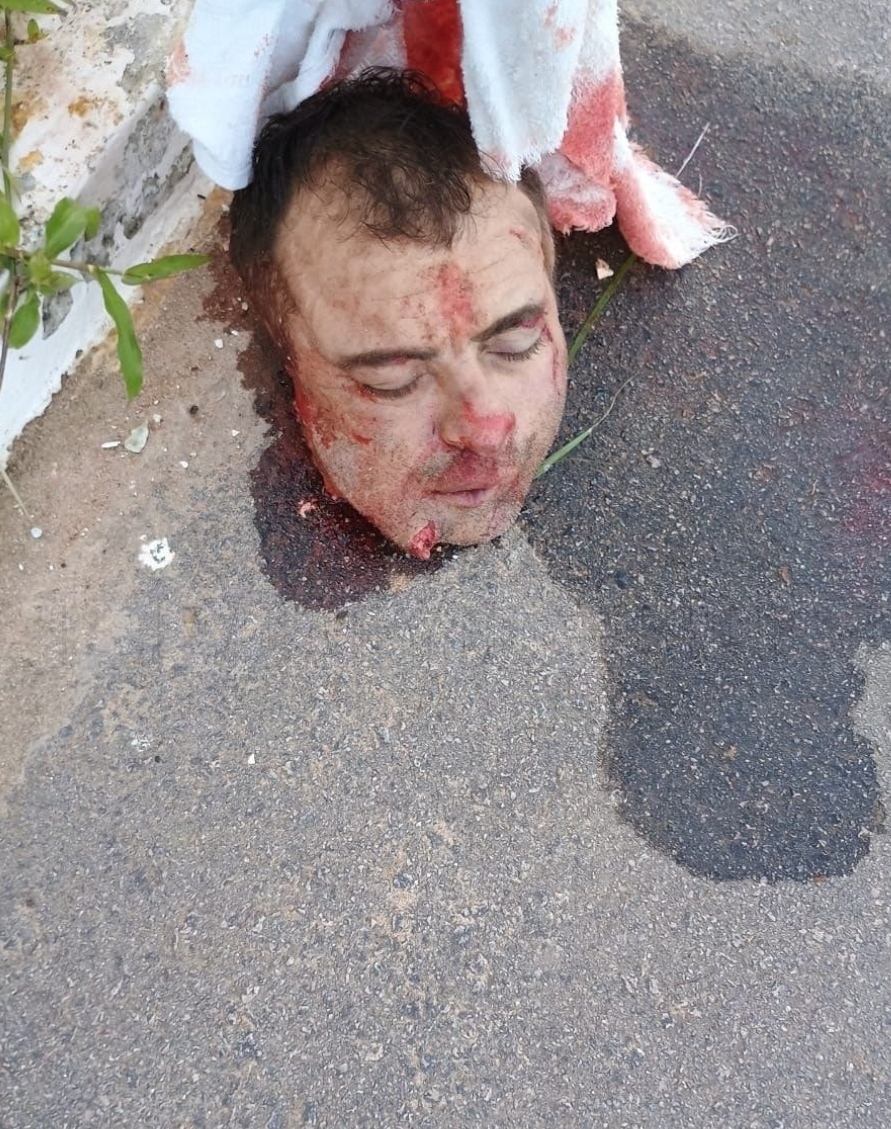 Drunk Dude Driving Motorcycle Gets Decapitated In Accident