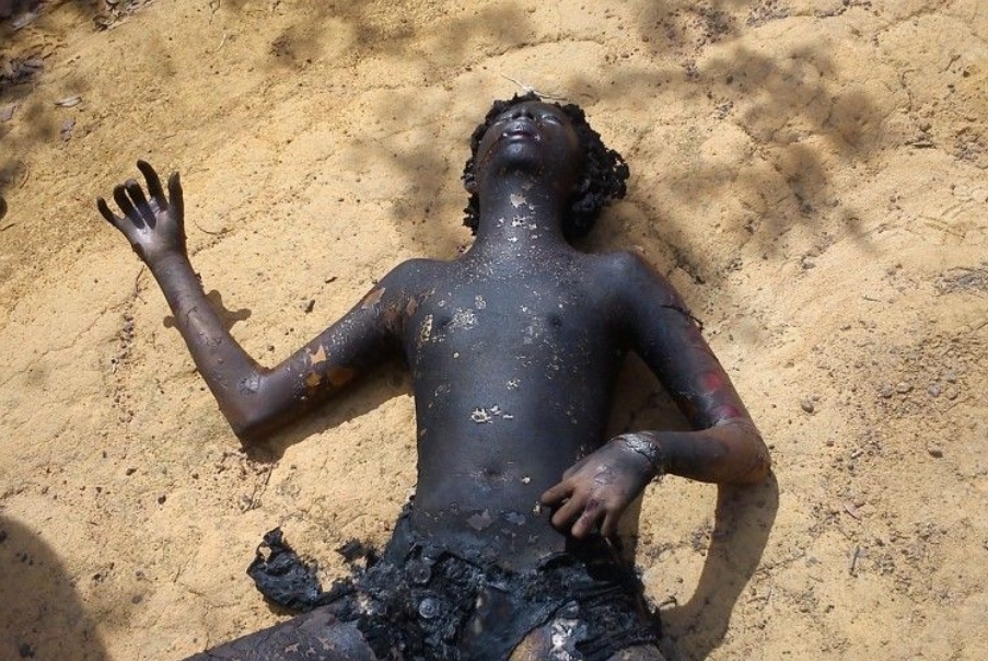 Prostitute Gets Beaten Unconscious And Burned Alive