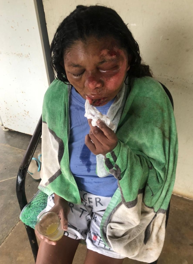 Woman Gets Found Naked And With Signs Of Sexual Assault