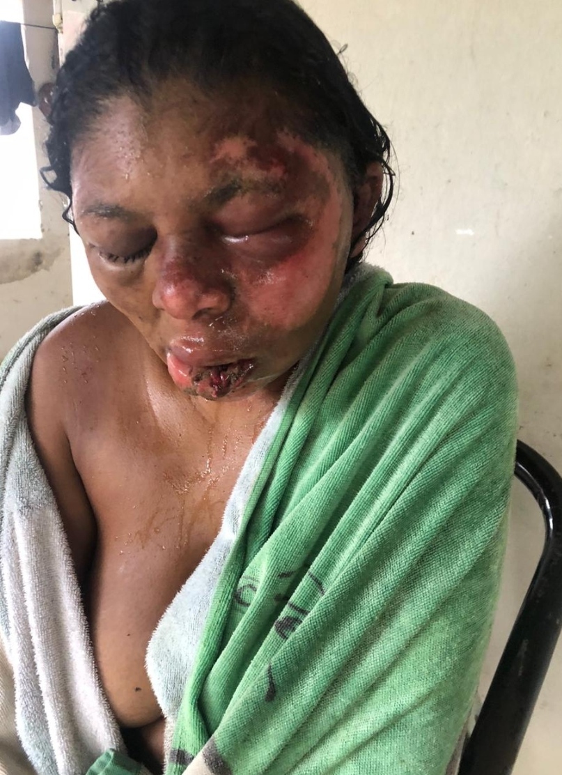 Woman Gets Found Naked And With Signs Of Sexual Assault