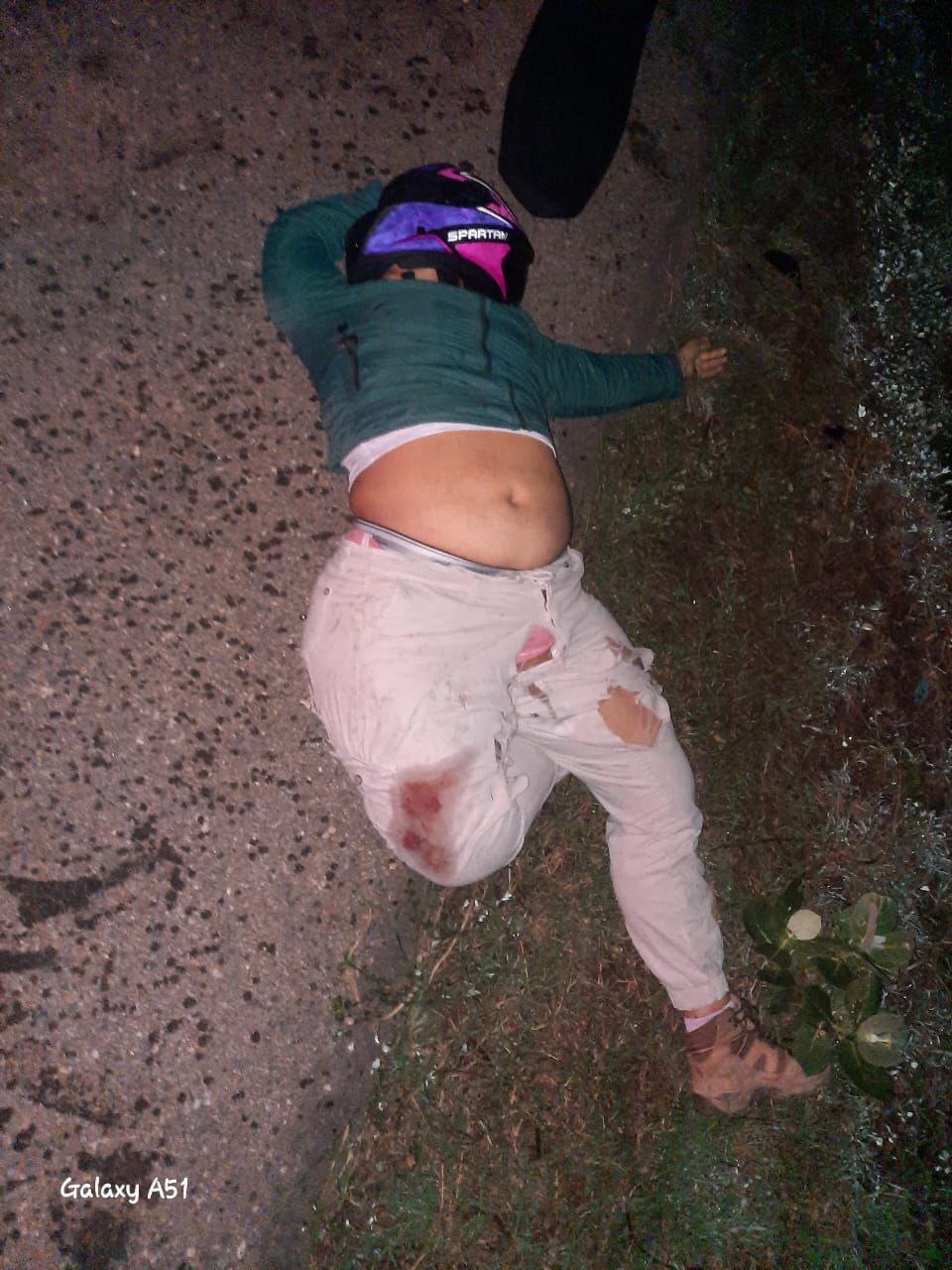 2 People Riding Motorcycle Die On Road