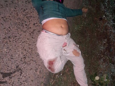 2 People Riding Motorcycle Die On Road