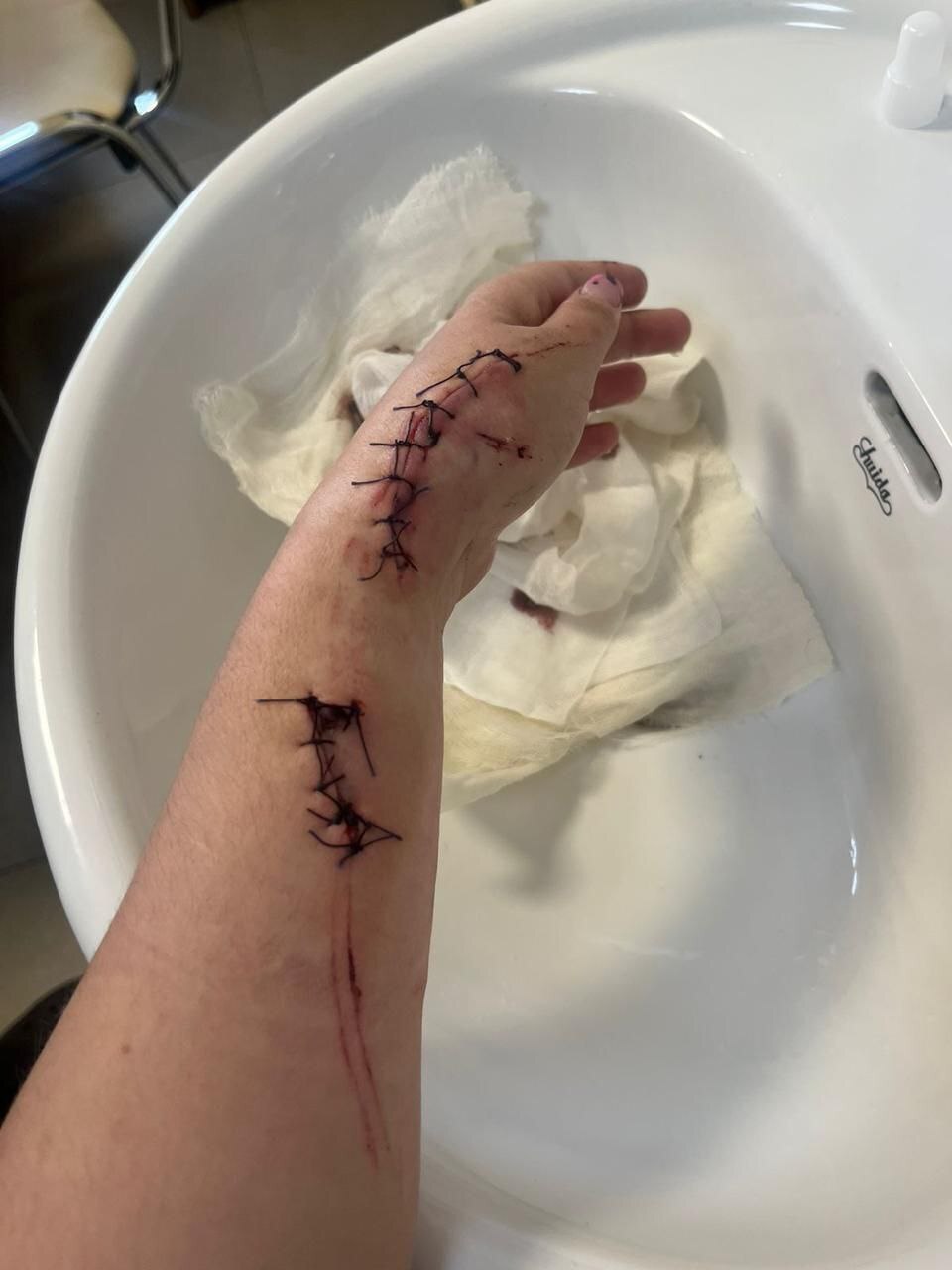 Ex-Boyfriend Beats His Girlfriend In Forest