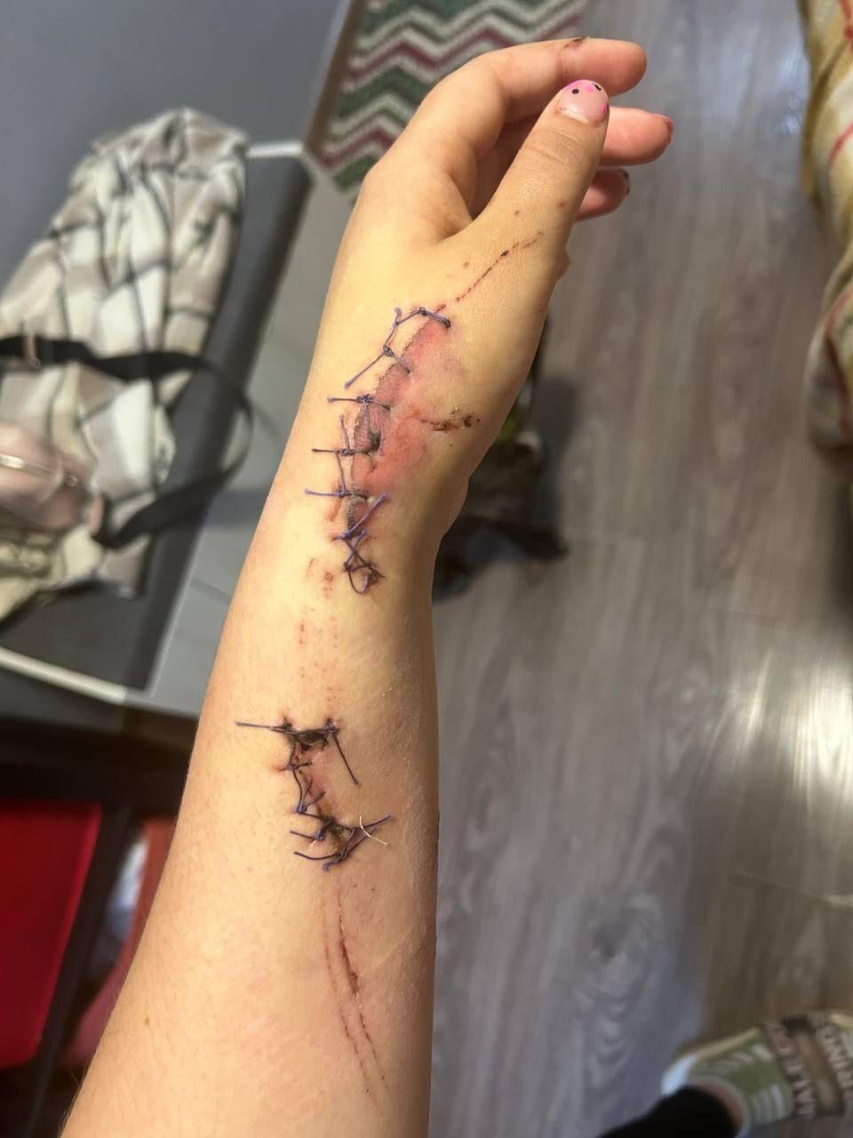 Ex-Boyfriend Beats His Girlfriend In Forest