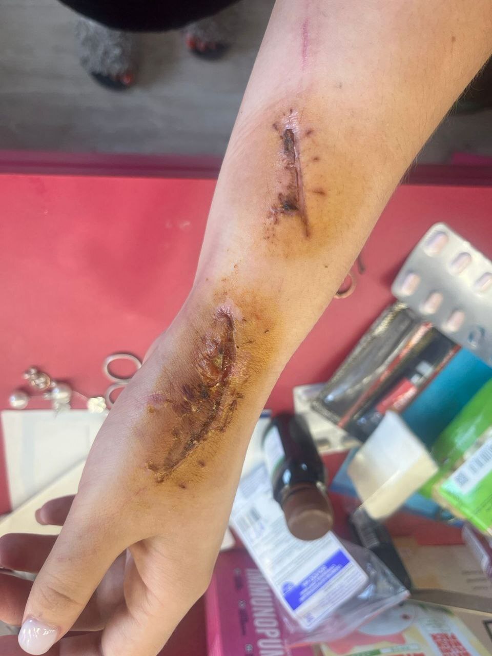 Ex-Boyfriend Beats His Girlfriend In Forest