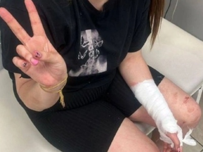 Ex-Boyfriend Beats His Girlfriend In Forest