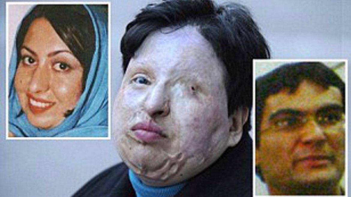 Student Pours Acid On Iranian Woman Because Of Rejected Love