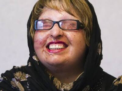 Student Pours Acid On Iranian Woman Because Of Rejected Love