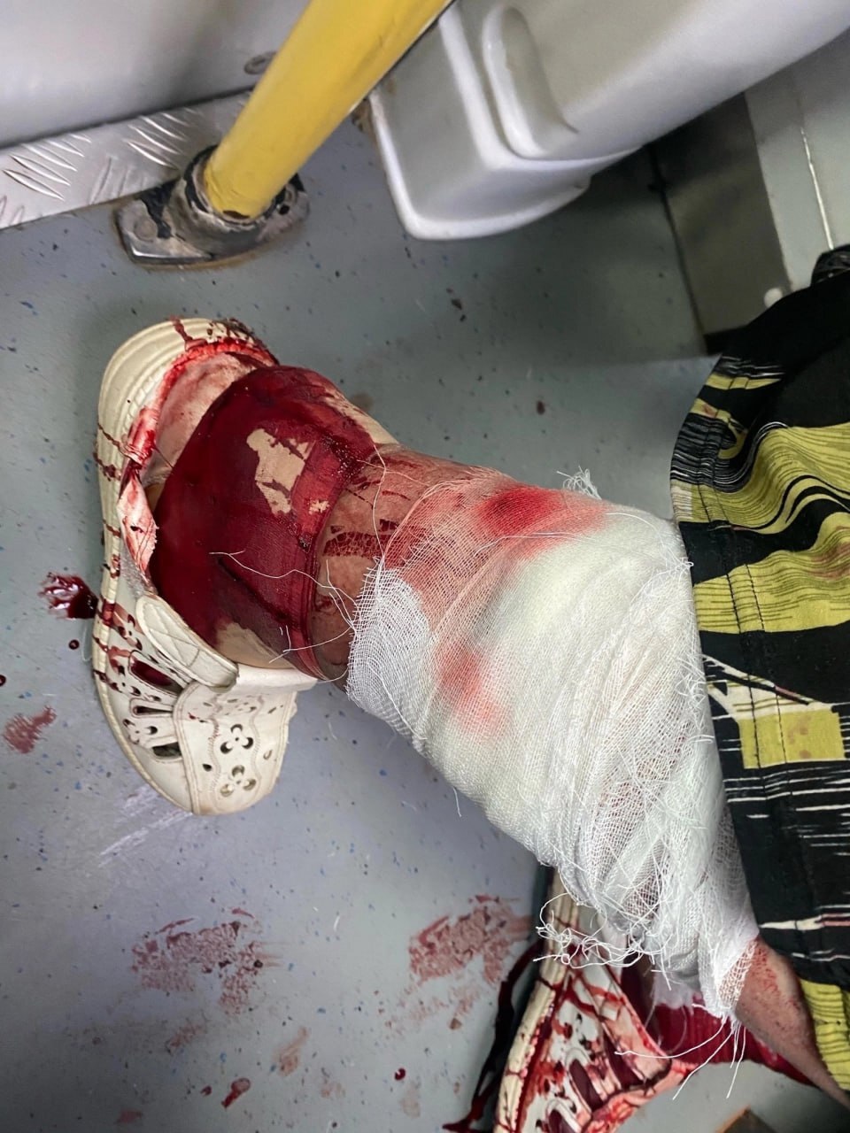 Don't Trust Stray Dogs