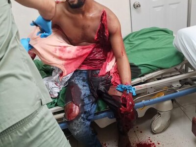 Man Brutally Slashed By Machete (Photos)